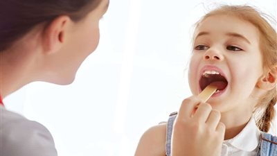 علاج التهاب اللوزتين في المنزل بـ 10 خطوات فقط.. متى يكون الالتهاب خطير؟