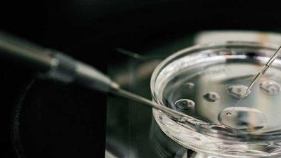 بعد نجاح أول عملية له في أستراليا.. ما هو بديل التلقيح الصناعي الجديد؟