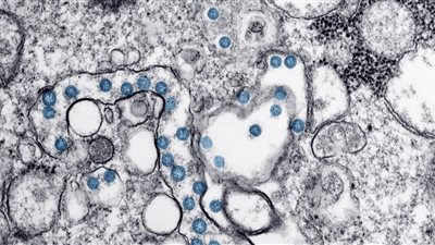 علماء يحذرون من الوباء الكبير: أكثر الأمراض المعدية فتكًا في تاريخ البشرية