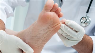 فقدان البصر وتلف الأوعية.. أبرز علامات الإصابة بمرض السكري