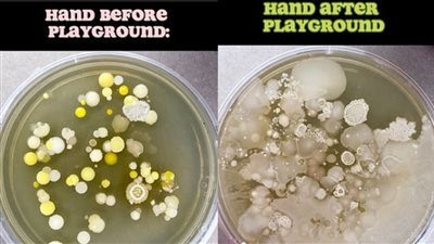عالم أحياء يحذر من المستعمرات البكتيرية الموجودة في ملاعب الأطفال