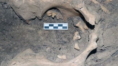 عمرها يتجاوز 3000 عام.. اكتشاف ورم في مبيض مومياء امرأة مصرية قديمة مدبب كالأسنان