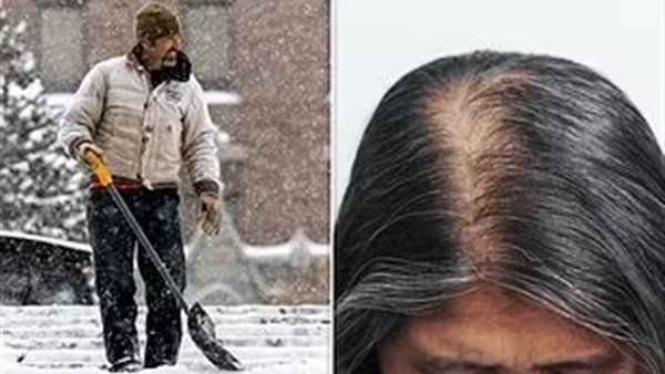 تساقط الشعر في الشتاء