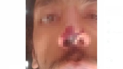 ضربوني وضيعوا مستقبلي.. طالب بالثانوية العامة يستغيث من حجب نتيجته العام الماضي بسبب مشادة داخل اللجنة