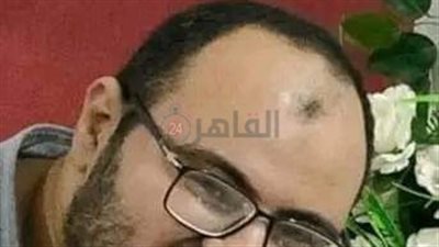 مصرع طبيب في حادث سقوط أسانسير بالفيوم 