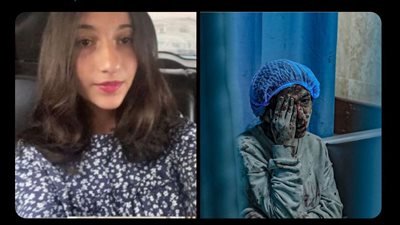 ستفقد عينها.. شقيقة الطفلة لولو الفلسطينية تستغيث بالمسؤولين: الأمل في نقلها فورًا لمصر لإجراء عملية خلال 24 ساعة