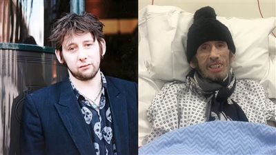 بعد وفاة مغني الروك الأيرلندي شين ماكجوان به.. ما هو التهاب الدماغ الفيروسي؟