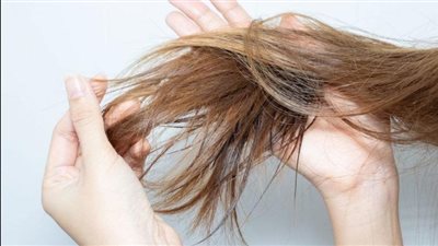 تأثير نقص العناصر الغذائية على صحة الشعر 