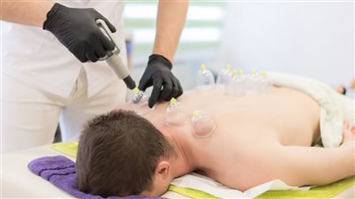 ممنوعات بعد الحجامة.. الإرشادات الكاملة بالمسموح والمحظور