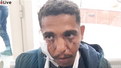 أحد الناجين من حادث انقلاب أتوبيس المنيا: السواق كان ماشي بيتمرجح | بث مباشر 