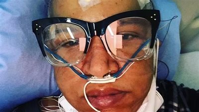 حياتي معدومة.. كندية مصابة بكورونا طويل الأجل تتقدم بطلب للقتل الرحيم