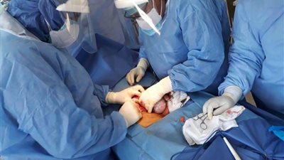 فريق طبي بـ”بنها التعليمي” يجري جراحة ناجحة لمريض بفيروس كورونا