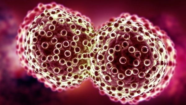 الأورام السرطانية