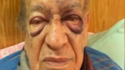 خبطه توك توك.. تامر أمين يكشف تفاصيل حالة وسيم السيسي بعد تعرضه لحادث سير