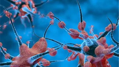 باحثون يطورون أداة للذكاء الاصطناعي تستخدم في فحص الاضطرابات العصبية