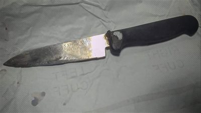 دخل بالخطأ من فتحة الشرج.. مدير مستشفى المنصورة الدولي يكشف تفاصيل استخراج سكين مطبخ من قولون مريض بالدقهلية