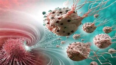 الهرموني والموجه أبرزها.. تعرف على أنواع علاجات الأورام السرطانية