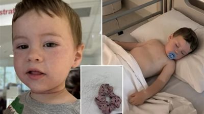 لف على رقبته.. اختناق طفل رضيع بسبب شعر والدته