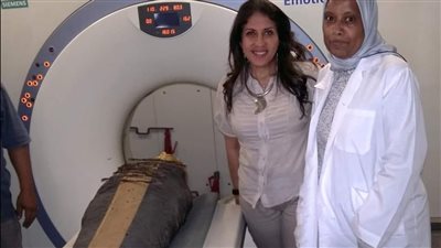 بها أسرار.. الآشعة المقطعية ترصد 6 صور لمومياء الصبي الذهبي