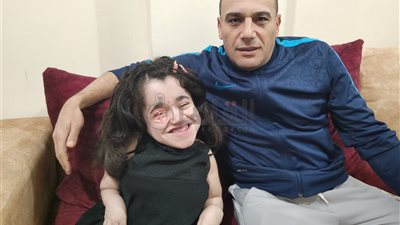 فتاة بالغردقة مصابة بمرض العظام الزجاجي: بتغلب على المرض بالرسم وأنا أهلاوية وبحب شيكابالا