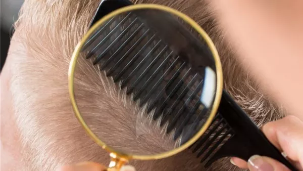 كيفية التخلص من القمل