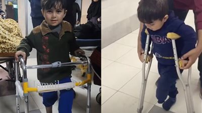 بشوشًا بالعكاز.. صغير فلسطيني يتدرب على المشي بعد بتر قدمه بسبب القصف الإسرائيلي