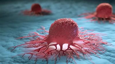 بمناسبة يوم الصحة العالمي.. أبرز النصائح الصحية للوقاية من السرطان