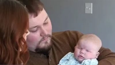 رضيعة ولدت بلا عيون بسبب مرض وراثي نادر.. القصة الكاملة