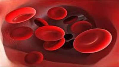 أبرزها شحوب الجلد والأظافر.. تعرف على أعراض نقص الحديد