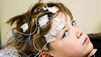 غثيان وتغييرات في السمع.. تعرف على أعراض الصرع بمرحلة الطفولة