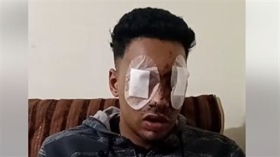 كنت بدافع عن شاب.. طالب يفقد عينيه أثناء فضه لمشاجرة بالمقطم| فيديو 