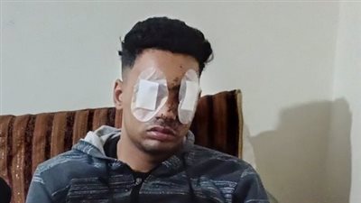 خسر عينه بطلق خرطوش.. القبض على المتهم بالاعتداء على الطالب فادي محمد بالمقطم 