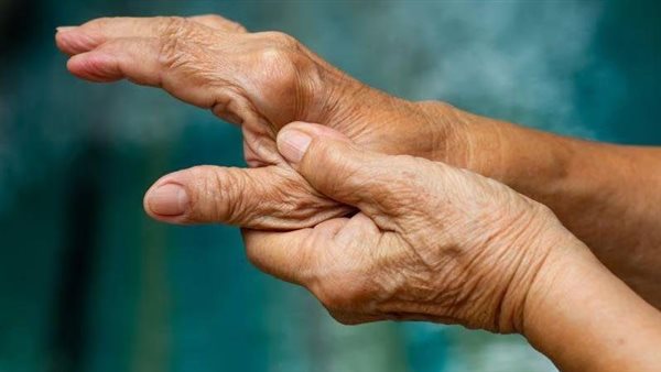  صورة تعبيرية 