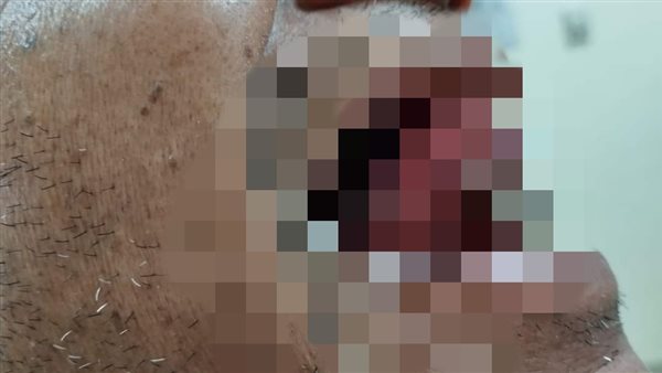 أطباء مستشفى الباجور