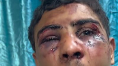 حطوا الحذاء الحديدي على وجهي.. أسير فلسطيني يروي تفاصيل تعذيبه من قوات الاحتلال 