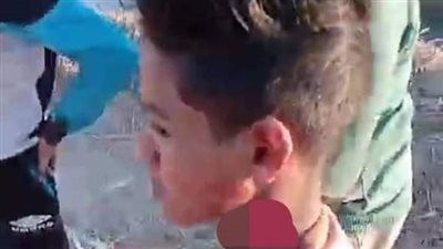 هاجموه بآلة حادة.. إصابة سائق توك توك بجرح بالرقبة على يد 3 لصوص بقنا