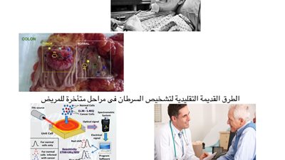 بحوث بمدينة زويل تقترب من اكتشاف تقنية جديدة للكشف المبكر عن الإصابة بالسرطان│خاص