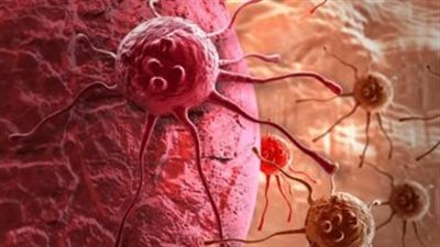 خبراء: آلاف البريطانيين لا يستفيدون من علاج السرطان الذي قد يطيل حياتهم