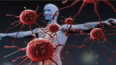 في شهر التوعية بأمراض المناعة.. تعرف على التهاب الجلد والعضلات