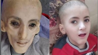 بعد تسببهم في مجاعة.. إسرائيليون يشبهون الفلسطيني يزن الكفارنة بالكائن الفضائي