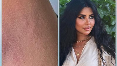 ميكب أرتست تستغيث من طليقها: شوه جسمي عشان خلعته.. أموّت نفسي عشان أرتاح؟| صور