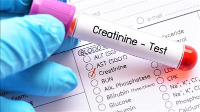 تعرف على أعراض ارتفاع مستوى الكرياتينين