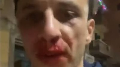 الفنان مصطفى سعد يتعرض للضرب من جاره بالإسكندرية: بهدلني ومرمطني قدام عيالي وهاخد حقي بالقانون| بث مباشر 