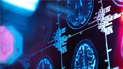 العلماء يحددون 37 حالة دماغية ترتبط بالسبب الرئيسي للوفاة المبكرة