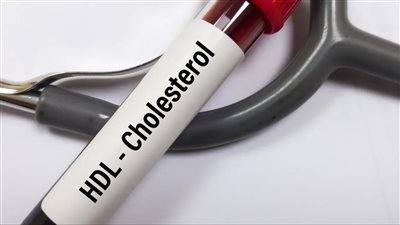 4 أعراض تظهر على ساقيك توضح إصابتك بارتفاع الكوليسترول في الدم.. تعرف عليها