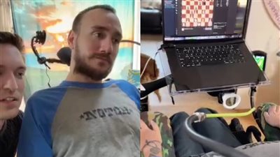 عن طريق التخاطر.. مصاب بشلل نصفي يلعب الشطرنج بعد زرع شريحة إيلون ماسك