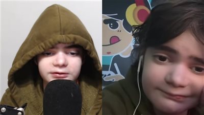 شكلها أصغر من سنها.. فتاة مصابة بمرض نادر للغاية تروي معاناتها: مقدرتش أكمل دراستي| خاص