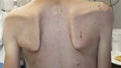 حرمان من الطعام وكيّ بالنار.. محكمة أمريكية تقضي بالسجن 30 عامًا ضد سيدة بتهمة تعذيب أطفالها