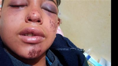 كتفوه وربطوا رقبته بحبل.. القبض على متهمين بمحاولة قتل طالب لسرقة توكتوك يستقله بدسوق 