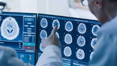 دراسة: وسائل منع الحمل الشائعة تزيد من فرص الإصابة بأورام الدماغ القاتلة